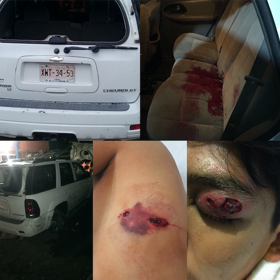Presuntos federales agreden a tiros a jóvenes de Tequexquitla