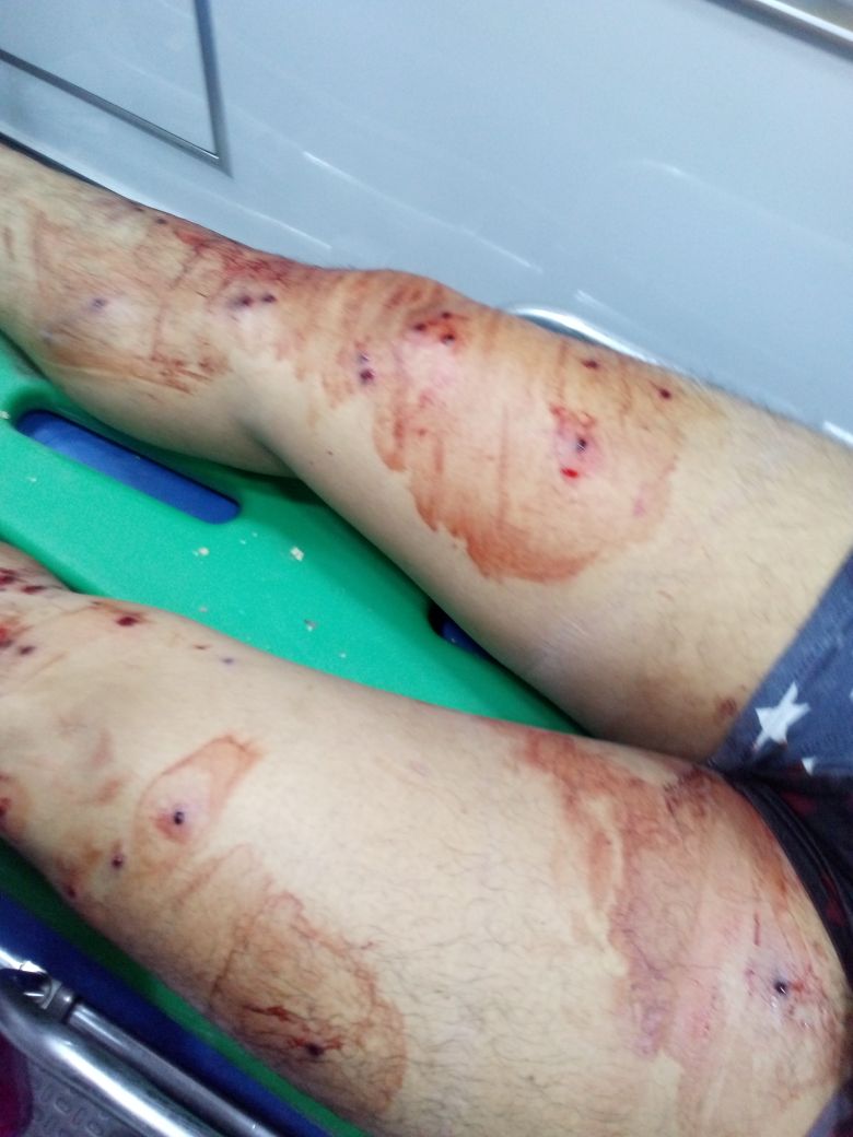 Balean a tres en riña en Huamantla