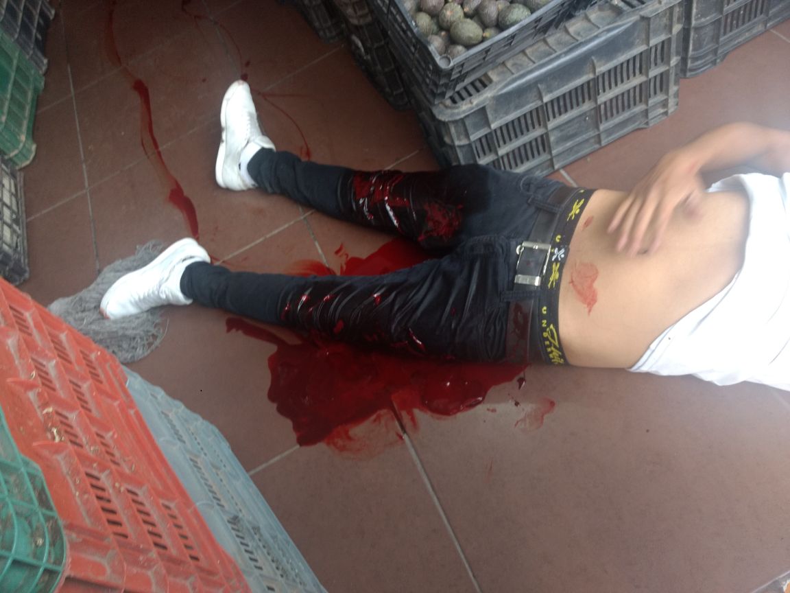 Hieren en Tzompantepec a joven en riña