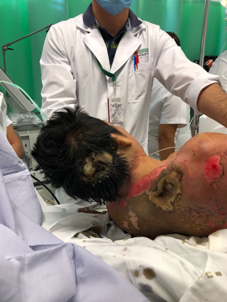 Hombre se electrocuta, le atienden de emergencia