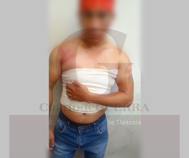 Denunciarán a policías de Quilehtla tras golpiza que propinaron a un joven