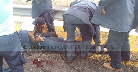 Joven sufre accidente de trabajo, en Hueyotlipan