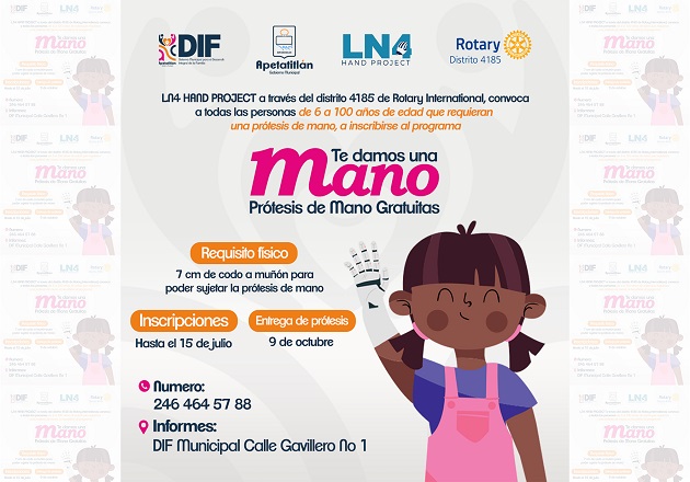 En Apetatitlán, con el programa ‘Te damos una mano’ darán prótesis de mano gratuitas