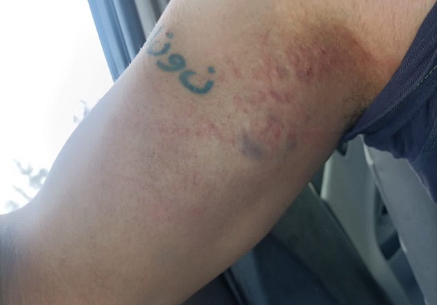 Condena UPET agresión contra dos reporteros ocurrida en San Cosme Xaloztoc