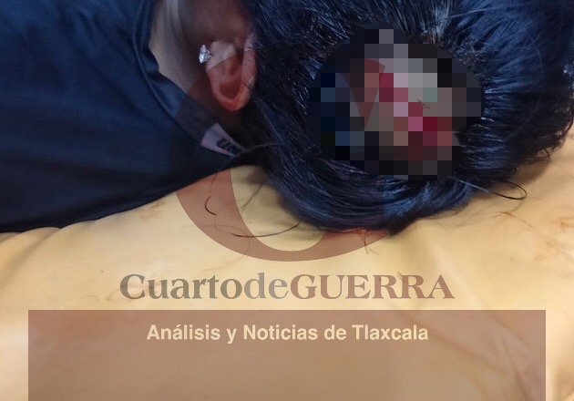 Hieren de un balazo a un hombre en supuesta riña por hecho de tránsito, en Nativitas