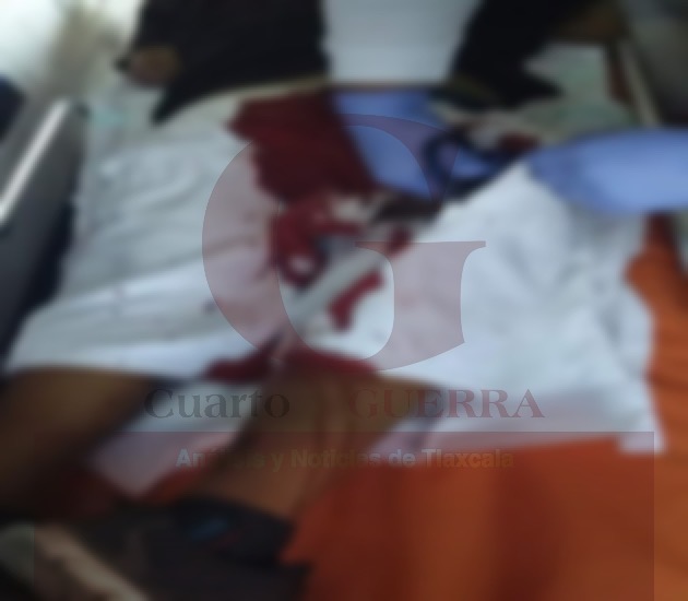 Balean y hieren a un hombre, en Tepeyanco