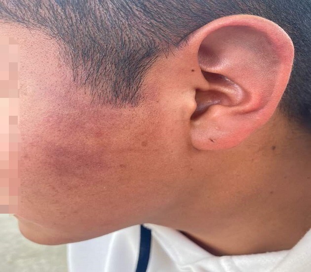 Denuncian penalmente a alcalde de Cuapiaxtla; presuntamente golpeó a policías