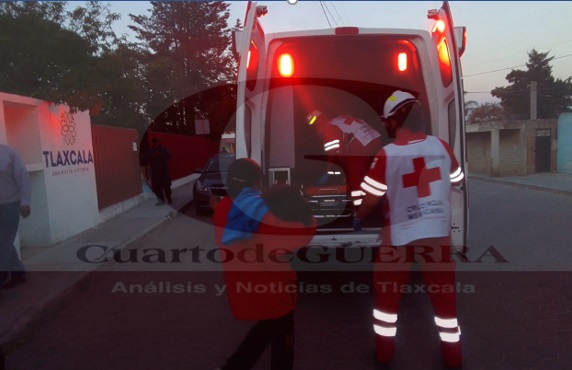 Caballo muerde a una niña de cinco años en Panotla