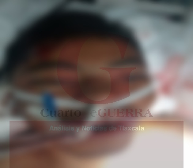 Muere en el hospital supuesto ladrón que fue golpeado brutalmente en San Pablo del Monte