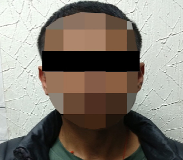 Aprehende PGJE a masculino por lesiones dolosas