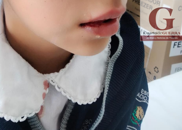 Denuncian caso de violencia física en primaria de Xaltocan