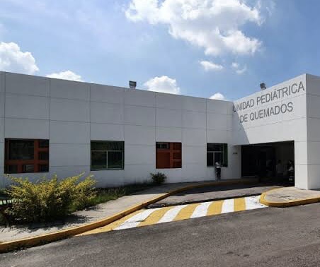 En Tlaxco, se electrocuta menor de edad y presenta quemaduras en 70% de su cuerpo