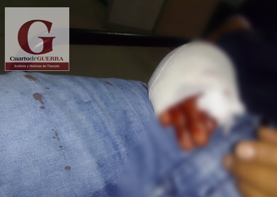Hieren de bala a un hombre que se estacionó en una entrada, en Panotla