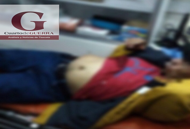 Se corta tras intento fallido de abrir una lata de sardinas, en Atlangatepec