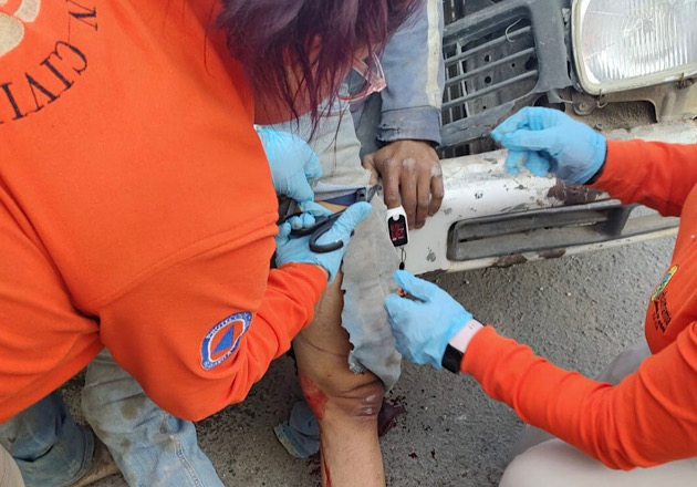 Brinda atención inmediata Policía de Huamantla a persona lesionada por accidente
