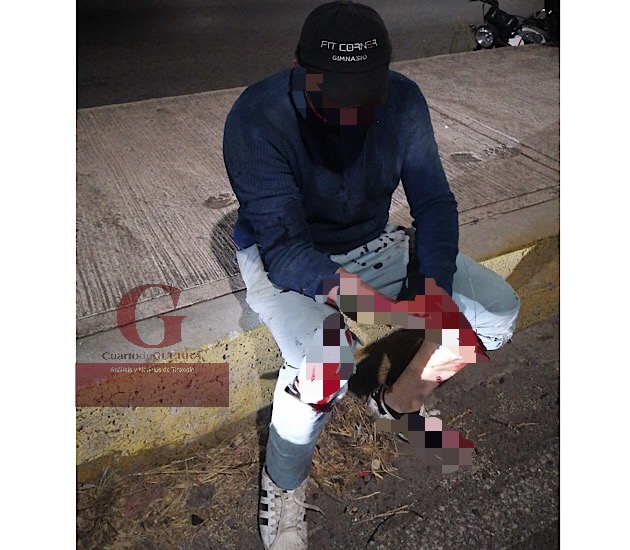 Motociclista derrapa y queda lesionado en Tepetomatitlán