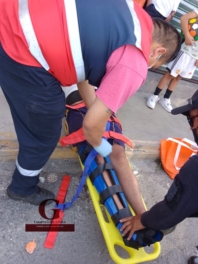 Niña resulta gravemente lesionada al viajar en moto junto a su familia, en Nativitas