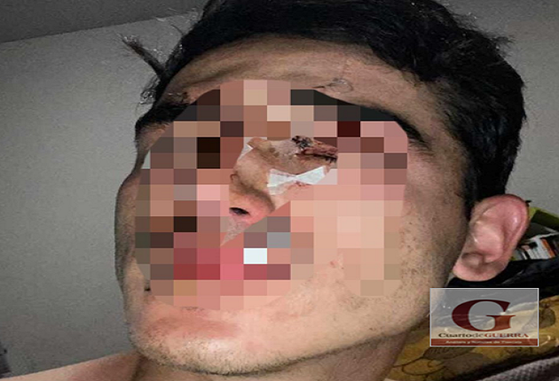 Presuntos alumnos de odontología de la UATx golpean con una botella a estudiante, dentro de un antro, en Totolac