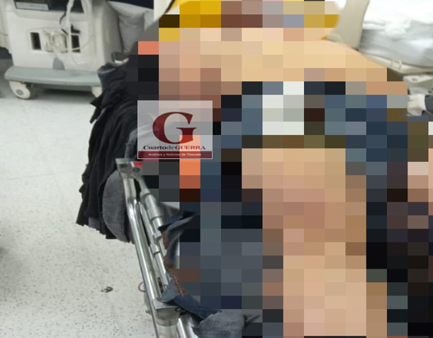 Fallece hombre en su traslado al hospital,  tras ser atropellado en Xiloxoxtla