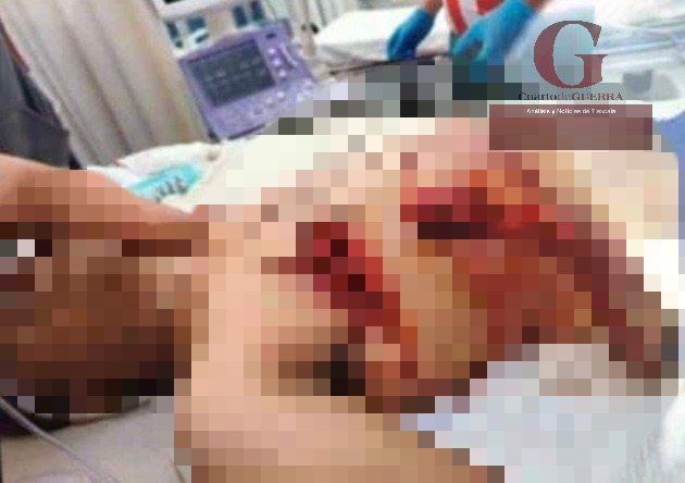 Entre la vida y la muerte se encuentra hombre por asta de toro en la ‘Ixtencada’