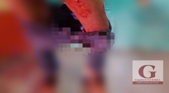 Intento de asalto en Panotla deja a un herido de bala y a una lesionada por golpe en la cabeza