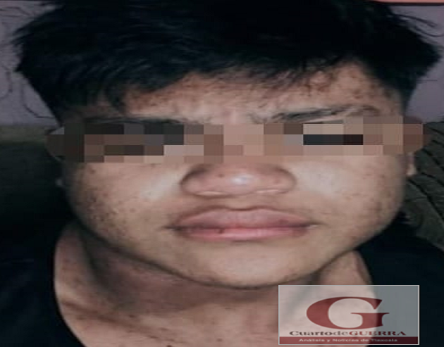 Era menor de 17 años, hombre encontrado calcinado en El Carmen Aztama, Teolocholco