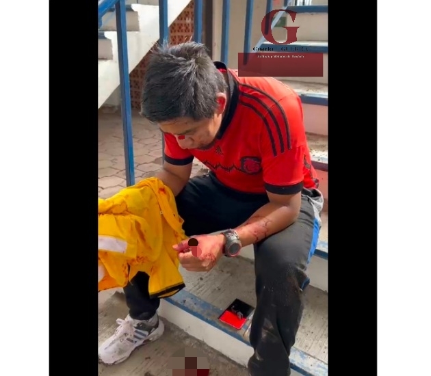 Árbitro es brutalmente agredido durante un partido de fútbol amateur, en Apetatitlán