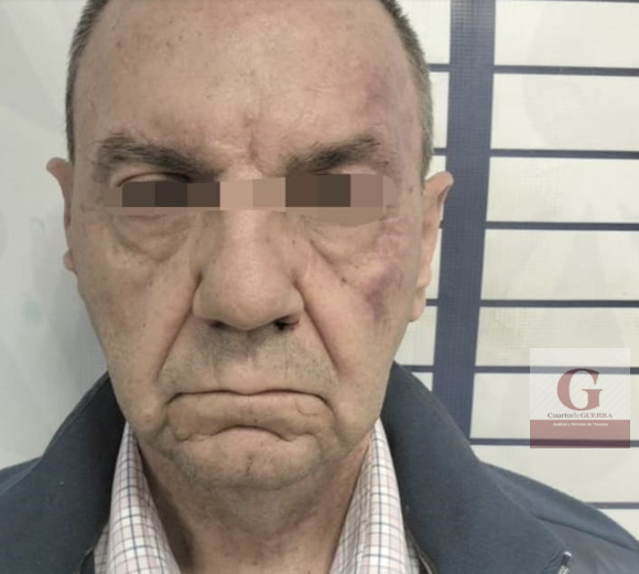 ¡Cayó el tirador de la Vía Atlixcáyotl! Tras feroz tiroteo capturan a empresario español en exclusivo residencial